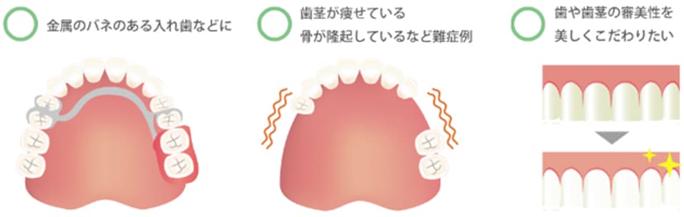 ご利用対象