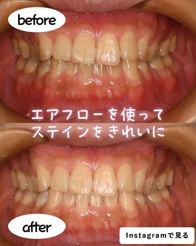 エアフロ―を使ってステインをきれいに