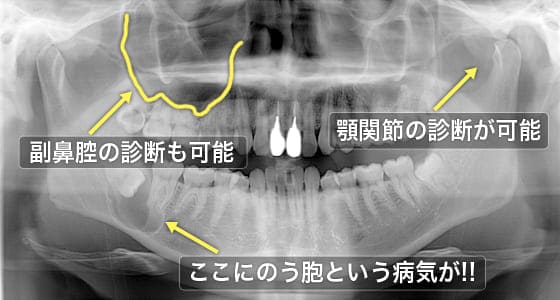 レントゲン検査